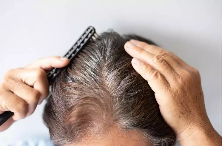 How long does it take for hair to grow back after hair loss?